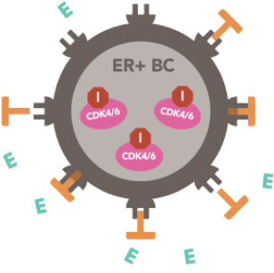 Illustration of how ZOLADEX reduces estrogen made by the ovaries and tamoxifen blocks estrogen from breast cancer cells